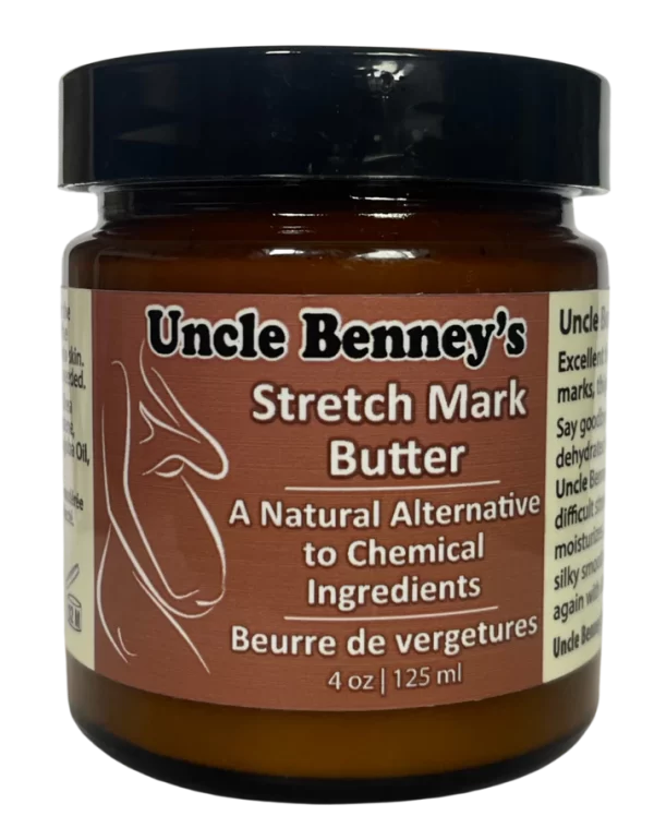 Uncle Benney's Stretch Mark Butter