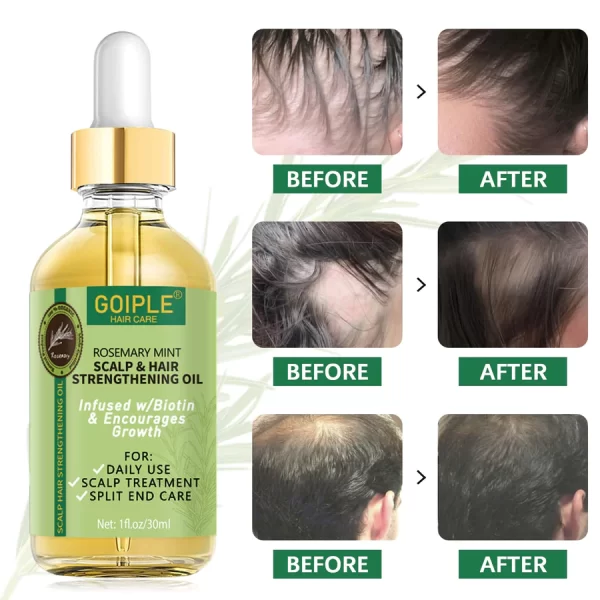 GOIPLE Organic Rosemary Oil For Hair Growth 1oz - Image 3